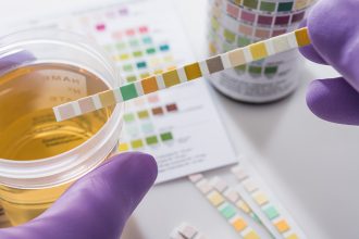 drug testing